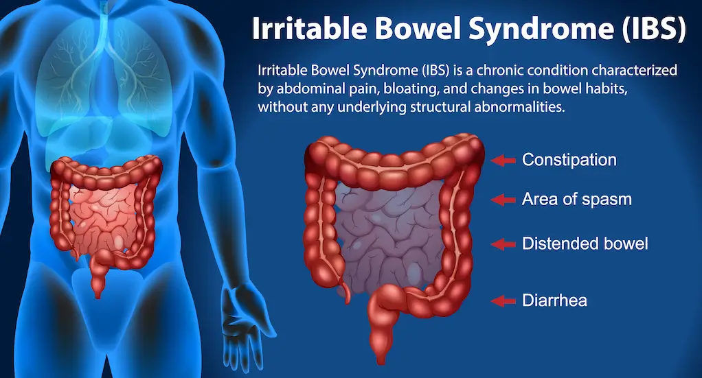 IBS Treatment in Jaipur